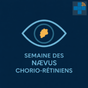 Examen ophtalmologique pour dépistage et suivi des nævus chorio-rétiniens.