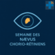 Examen ophtalmologique pour dépistage et suivi des nævus chorio-rétiniens.